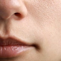 Alles, was Sie über Hauttypen wissen müssen