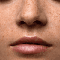 PIGMENTFLECKEN LOSWERDEN: Holen Sie sich Ihren ebenmäßigen Teint zurück! 